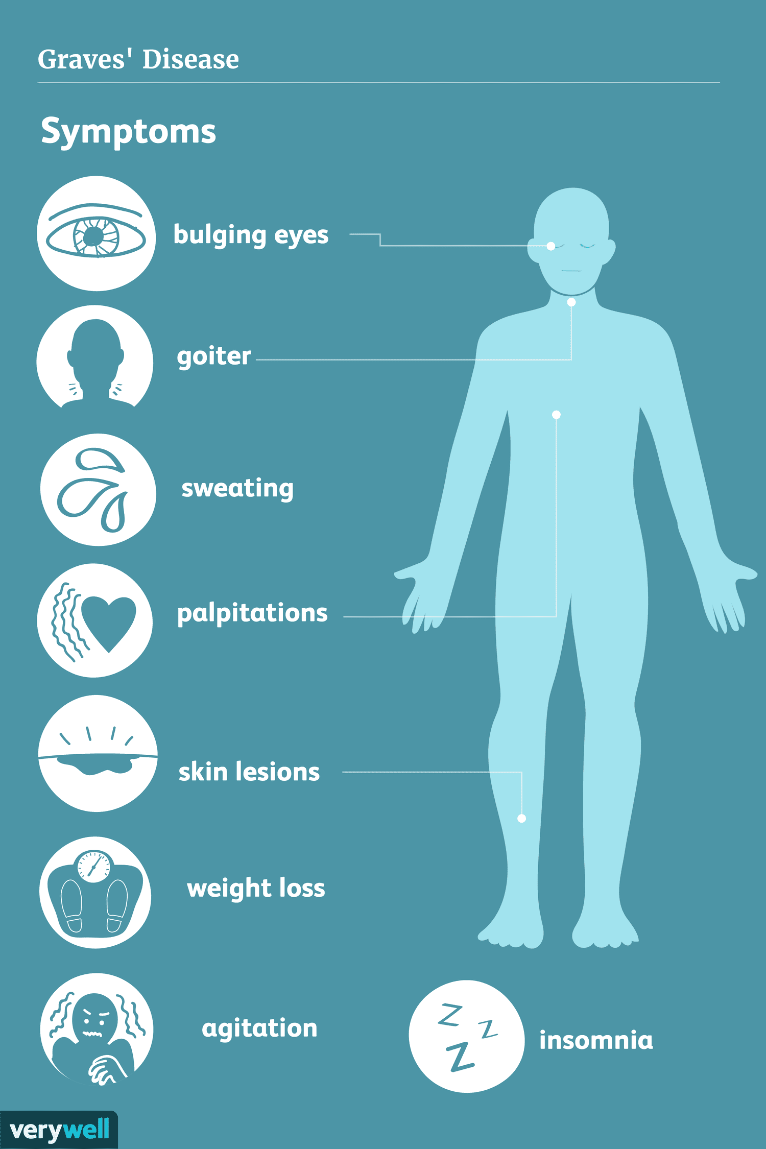 Graves Disease Signs Symptoms And Complications